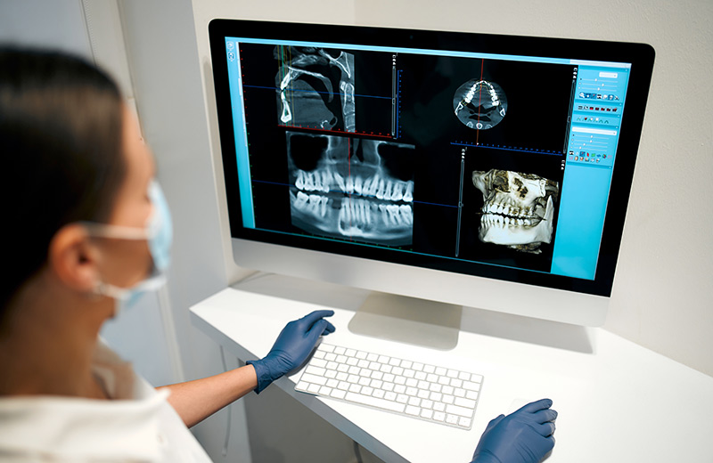 dr olszewska zahnartzt dvt 3d reontgen
